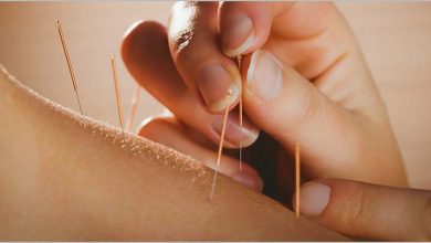 recall-healing-with-acupuncture-in-edmonton:-a-holistic-approach-to-wellness
